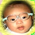 治療目的の乳児の眼鏡