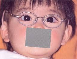 子供の治療目的のメガネ