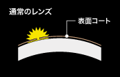 通常レンズ染色