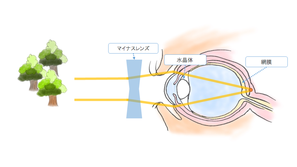 目からくる体の負担