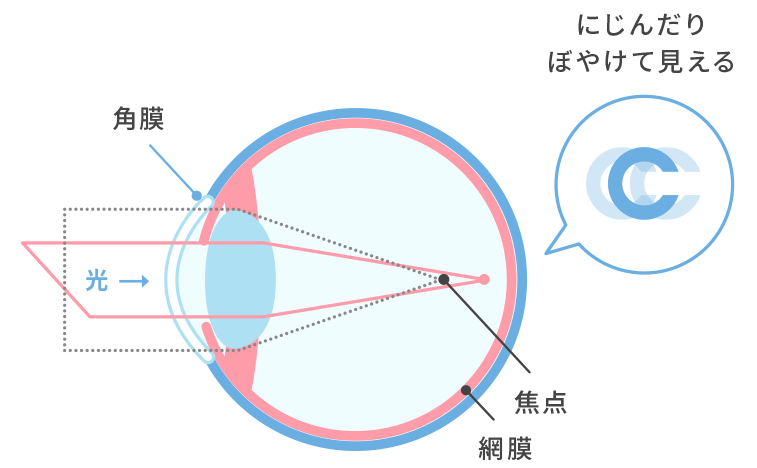 レンズアップルより引用